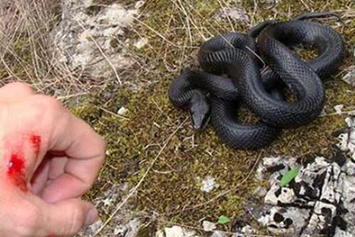  53-річного жителя Полтавщини вкусила змія