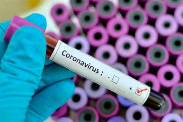 На Полтавщині 25 підтверджених випадків на коронавірус