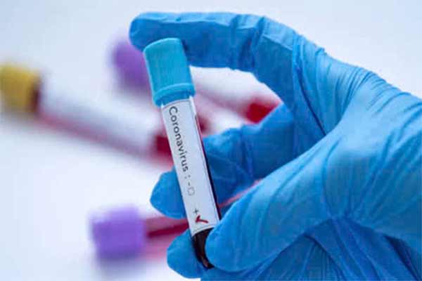 На Полтавщині за добу виявили 9 нових випадків захворювання на коронавірус
