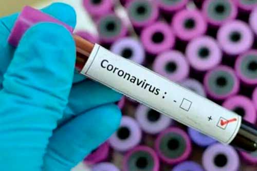 На Полтавщині вже другий день поспіль не фіксуюь нових випадків коронавірусу