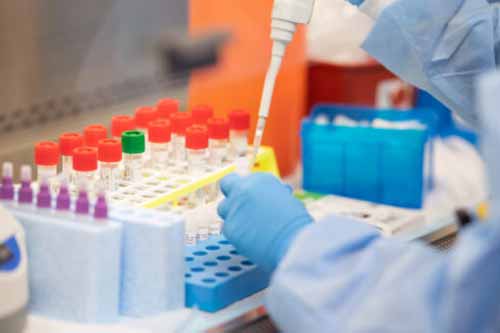 За минулу добу на Полтавщині зафіксували 8 нових випадків захворювання на COVID-19