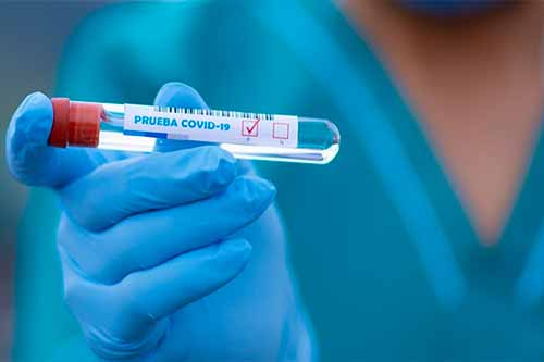 25 нових випадків захворюваності на COVID-19 зафіксували на Полтавщині