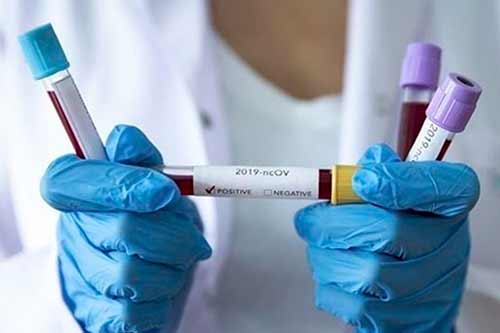 На Гребінківщині зафіксували перший випадок захворювання на коронавірус 