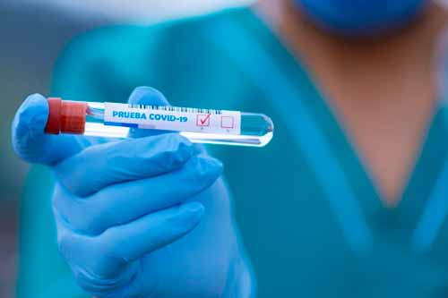 На Полтавщині 343 нових випадків коронавірусу, з них 10 у Оржицькому районі 