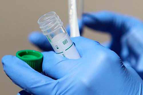 За добу на Полтавщині зафіксували 624 нових випадків COVID-19, 10 летальних