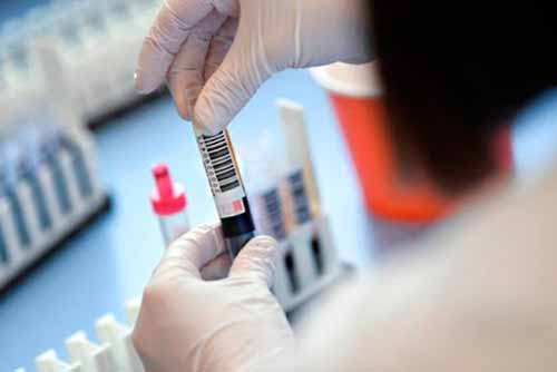 За добу на Полтавщині зареєстровано 153 нові випадки коронавірусу