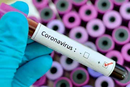 За добу на Гребінківщині виявили три нові випадки коронавірусу