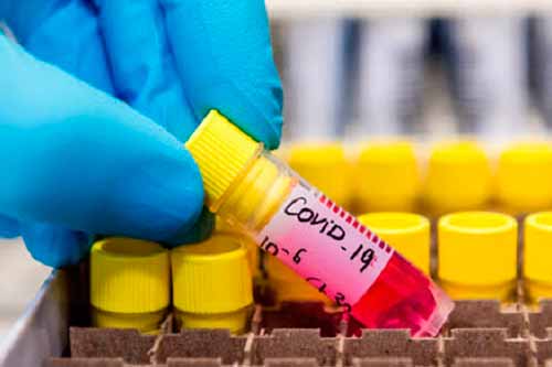 На Полтавщині через ускладнення COVID-19 померло п'ятеро людей