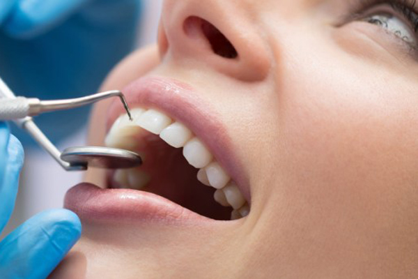 Лечение кариеса передовыми технологиями стоматологии