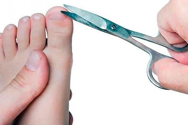 Вчимося педикюру: як правильно стригти нігті на ногах