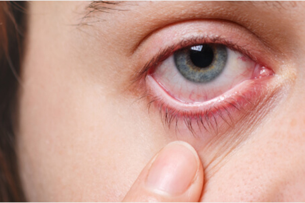 Как предотвратить повреждение зрительного нерва