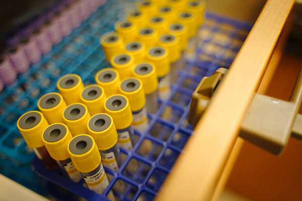 станції для забору крові