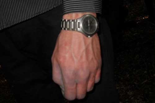 На Полтавщині знайшли труп чоловіка, просять допомогти встановити особу