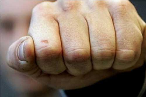 У Лубнах чоловік у стані алкогольного сп’яніння побив поліцейського 