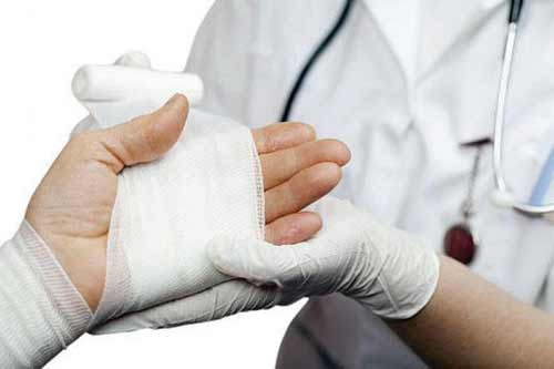 На Полтавщині оператор котельні отримав термічні опіки руки 