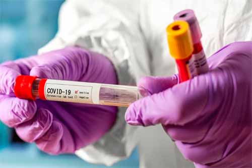 Полтавщина за рівнем епідемічної небезпеки поширення COVID-19 відноситься до «зеленої» зони