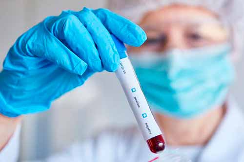 На Полтавщині – 20 нових випадків COVID-19