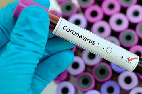 Минулої доби на Полтавщині підтвердили кілька нових випадків інфікування на COVID-19