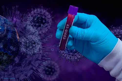 За минулу добу на Полтавщині виявили 172 випадки захворювання на COVID-19