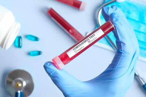 За добу на Полтавщині діагностували 180 випадків COVID-19