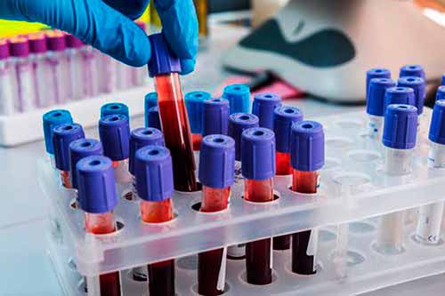 На Полтавщині за минулу добу зареєстровано 488 нових випадків захворювання на COVID-19