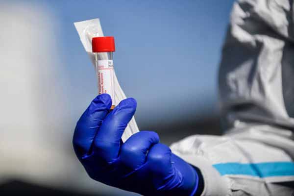 На Гребінківщині за минулу добу зареєстровано 5 нових випадків захворювання на COVID-19