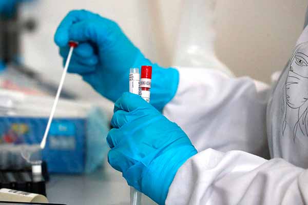 На Полтавщині за минулу добу зареєстровано 92 нових випадків захворювання на COVID-19