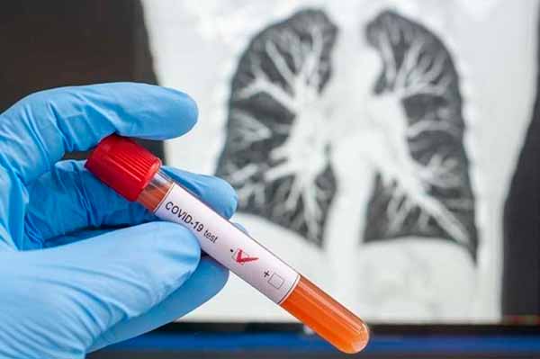 Від ускладнень, викликаних COVID-19, померло восьмеро полтавців