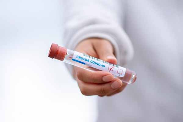 На Полтавщині за минулу добу коронавірус вперше виявлено у 100 осіб, зареєстровано 4 летальних випадки