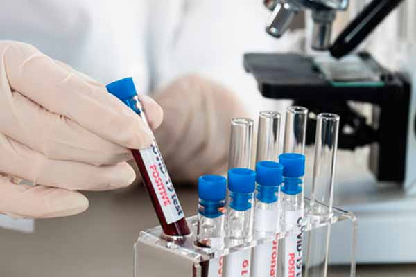 COVID-19 в Полтавській області. Епідемічна ситуація станом на 01 лютого