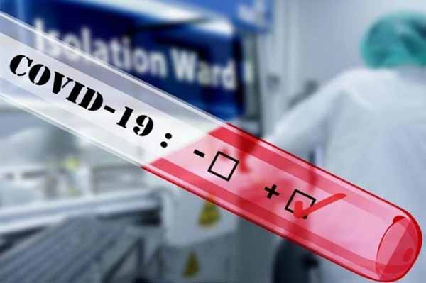 28 нових випадків захворювання на коронавірус виявили за добу в Гребінківській громаді