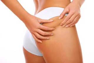 Целлюлит — как избавиться?