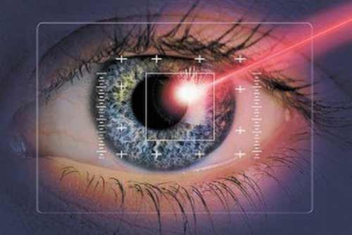 Как происходит лазерная коррекция зрения