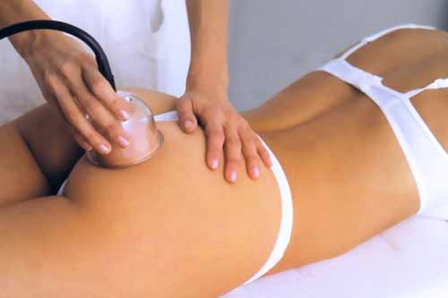 Баночный массаж от целлюлита, как эффективная бороба с «апельсиновой коркой»