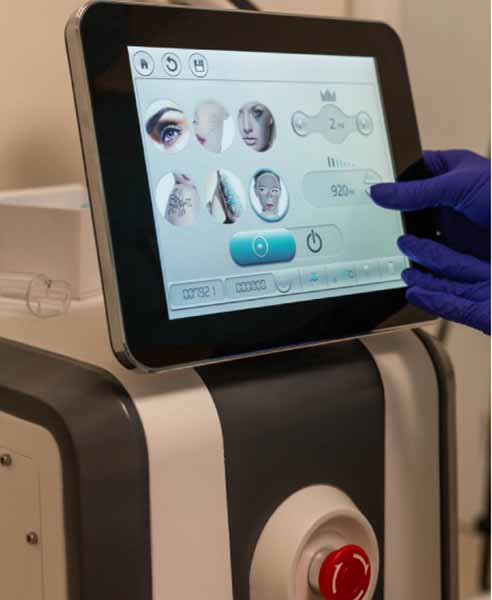 лазерна епіляція лазерна епіляція