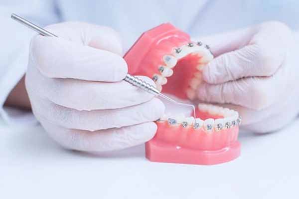 Неправильный прикус Неправильный прикус