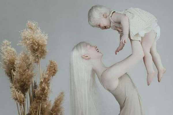 Міжнародний день поширення інформації про альбінізм