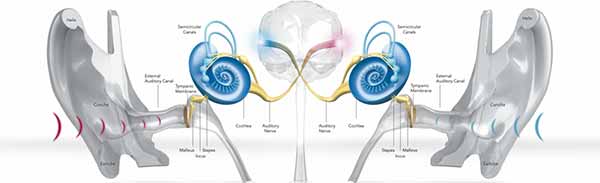 Внутриушные слуховые аппараты: история появления, развитие