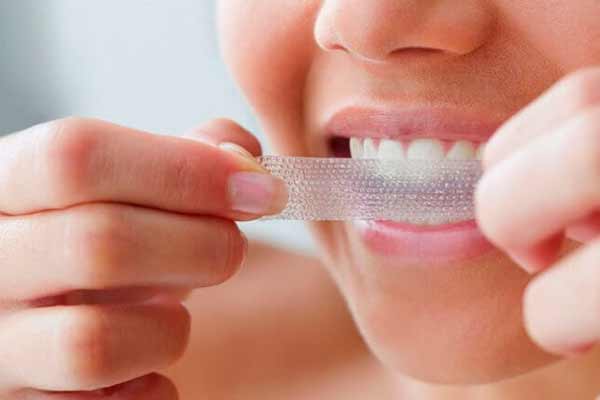 Відбілювання зубів в домашніх умовах