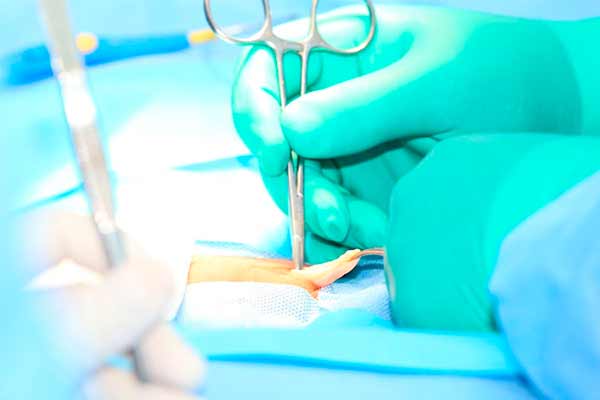 Абдоминальная хирургия: 2 основных метода проведения операций