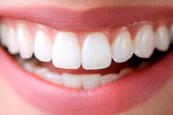 Современный способ вернуть красивую улыбку за пять дней