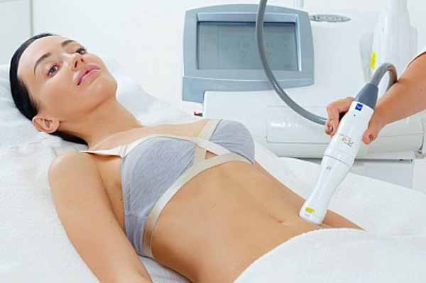 Лазерная шлифовка