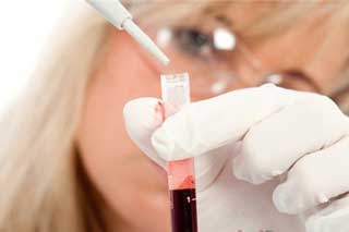  За аналізом крові можна визначити тривалість життя 