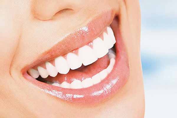  Як встановити прямі вініри недорого і за один візит до стоматолога 