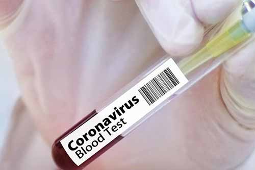 На Гребінківщині 13 нових випадків захворювання на COVID-19