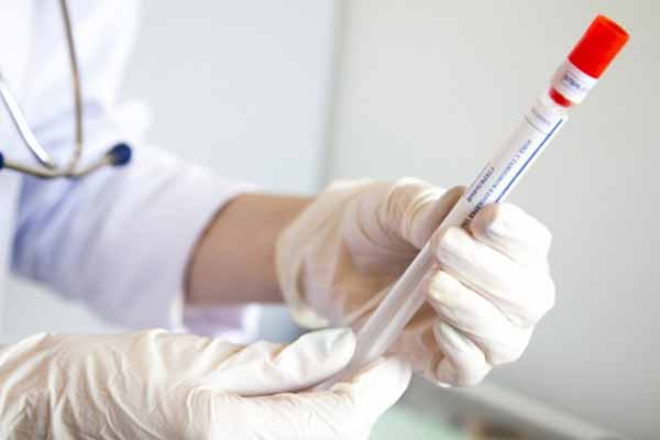 6 нових випадків захворювання на коронавірус виявили за добу на Гребінківщині