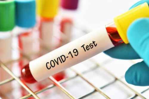 На Полтавщині виявили 104 нові випадки захворювання на COVID-19