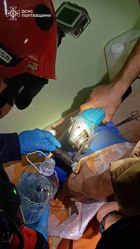 рятувальники вивільнили палець підлітка з металевого предмета