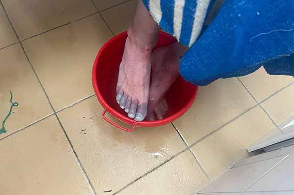 Житель Полтавщини отримав обмороження