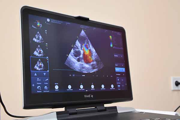 Фахівці Інституту серця завітали на Полтавщину Фахівці Інституту серця завітали на Полтавщину